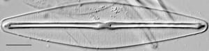 Frustulia rexii LM4