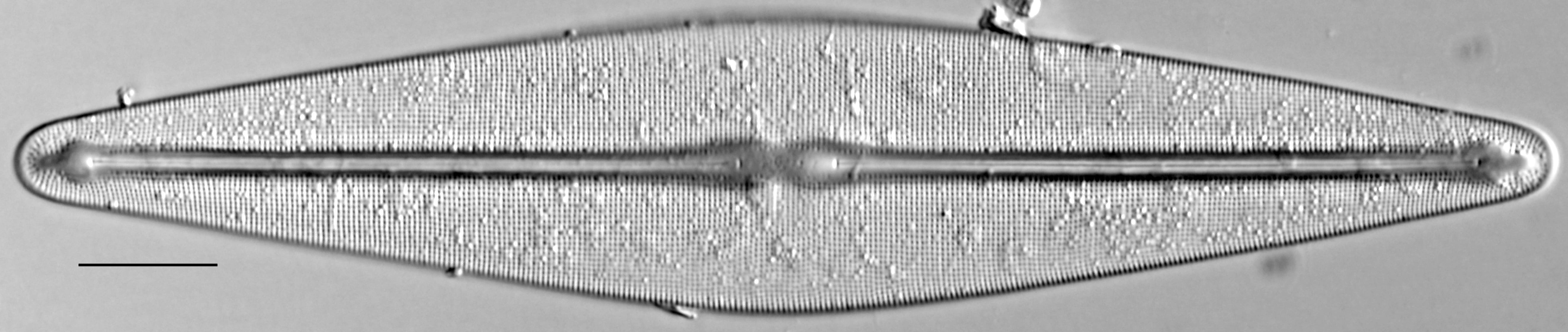 Frustulia rexii LM1