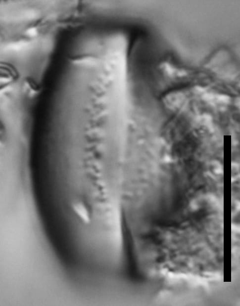 Chaetoceros muelleri LM4