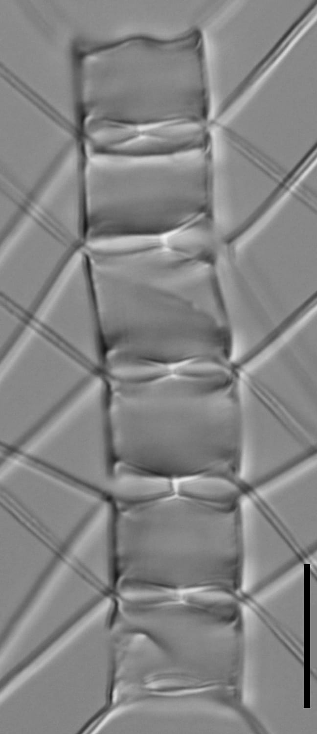 Chaetoceros muelleri LM5