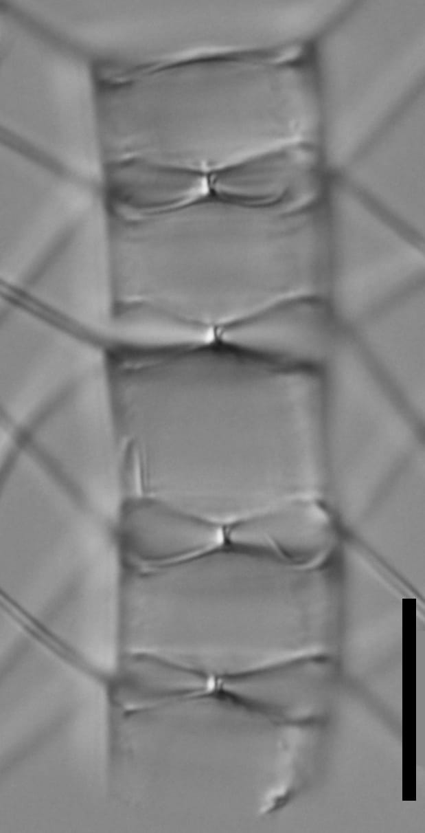 Chaetoceros muelleri LM2