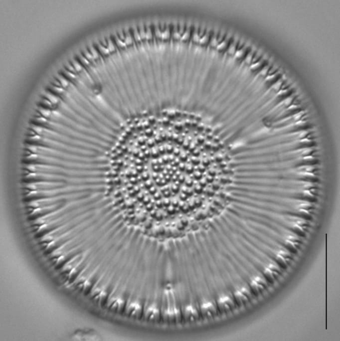 Lindavia intermedia LM1