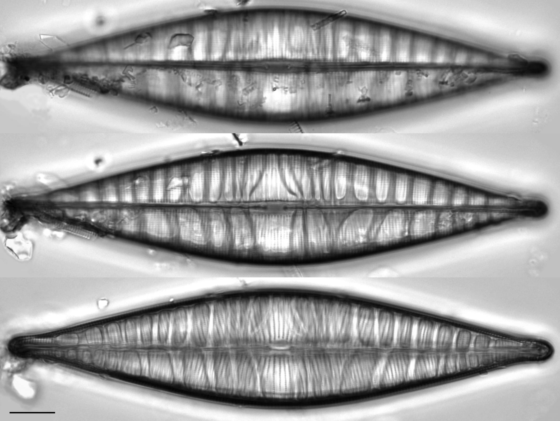 C Cuspidata Valve Forms Gray