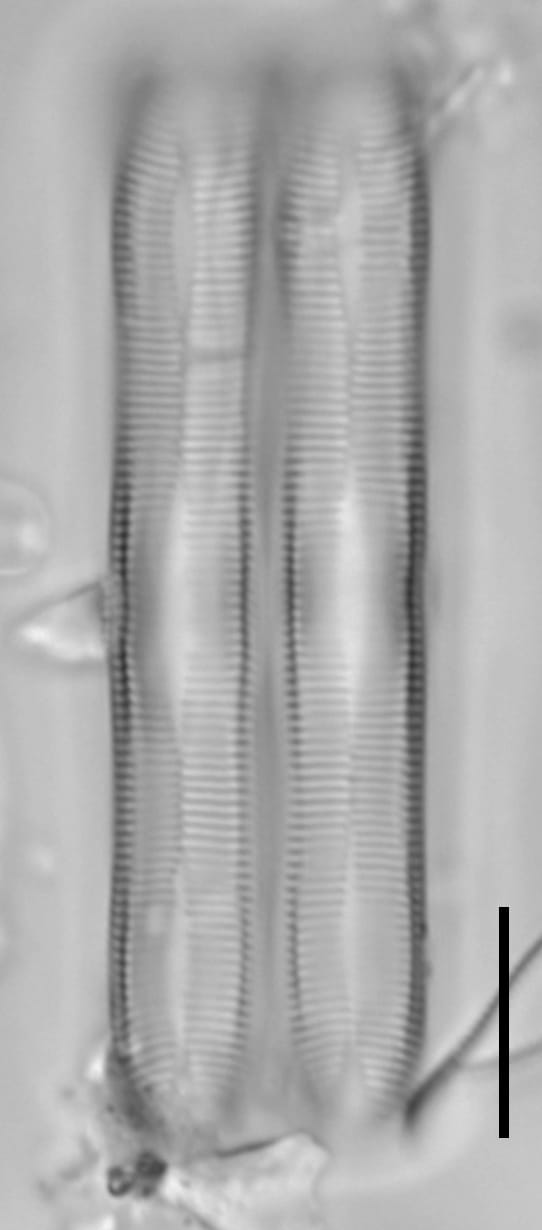 Caloneis Girdle view