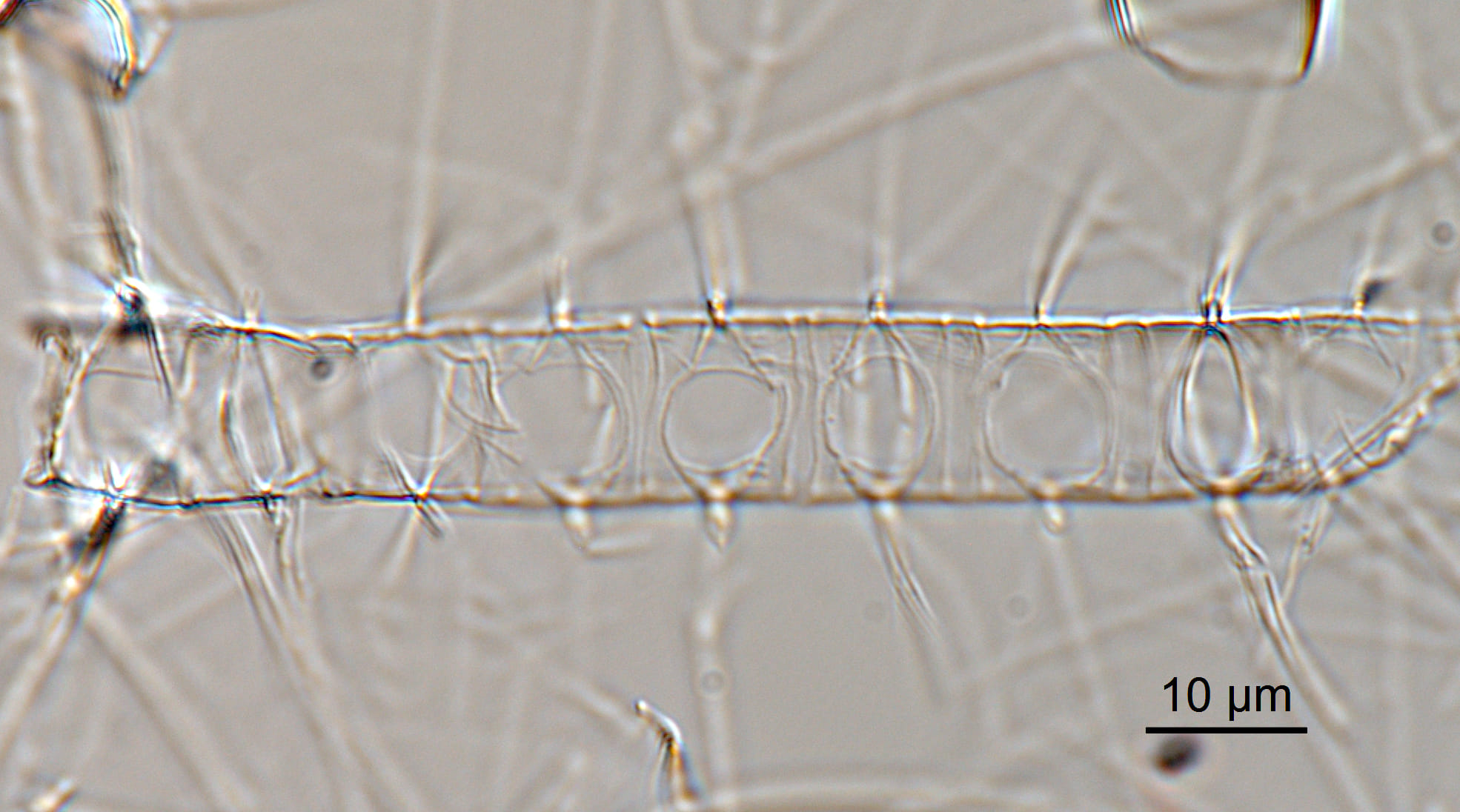 Chaetoceros constrictus LM4