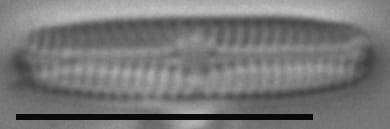 Chamaepinnularia krasskei LM2