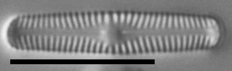 Chamaepinnularia krasskei LM7