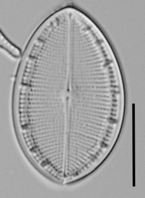 Cocconeis coreana LM1