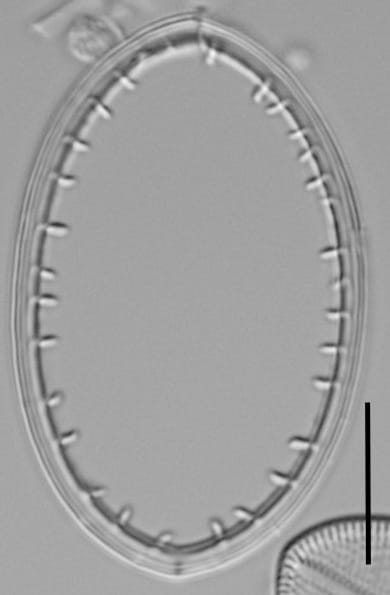 Cocconeis coreana LM6