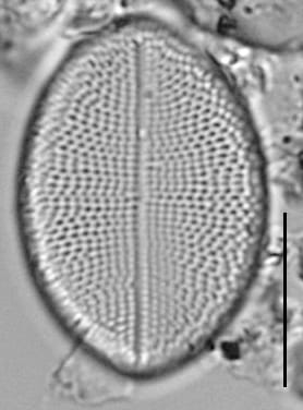 Cocconeis czarneckii LM2