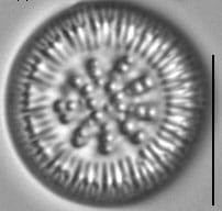 Lindavia radiosa LM5