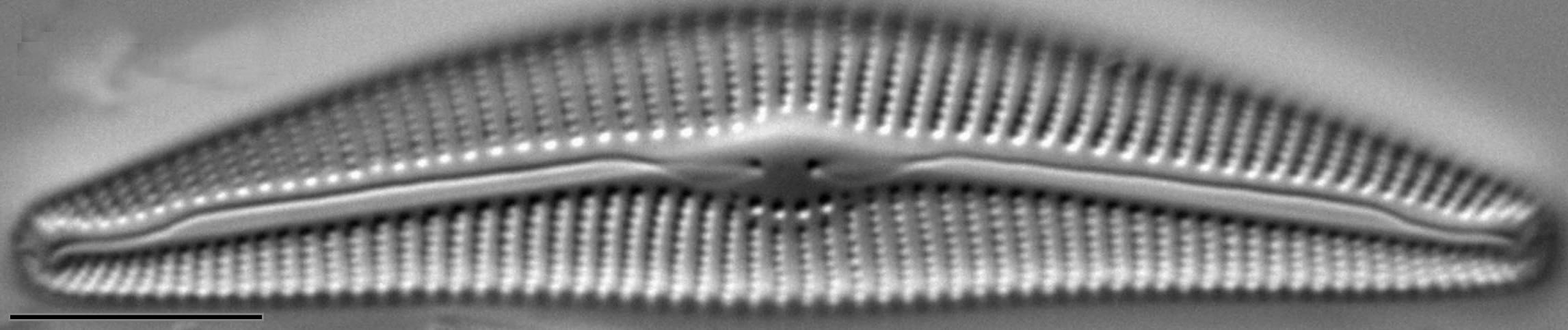 Cymbella Fontinalis LM3