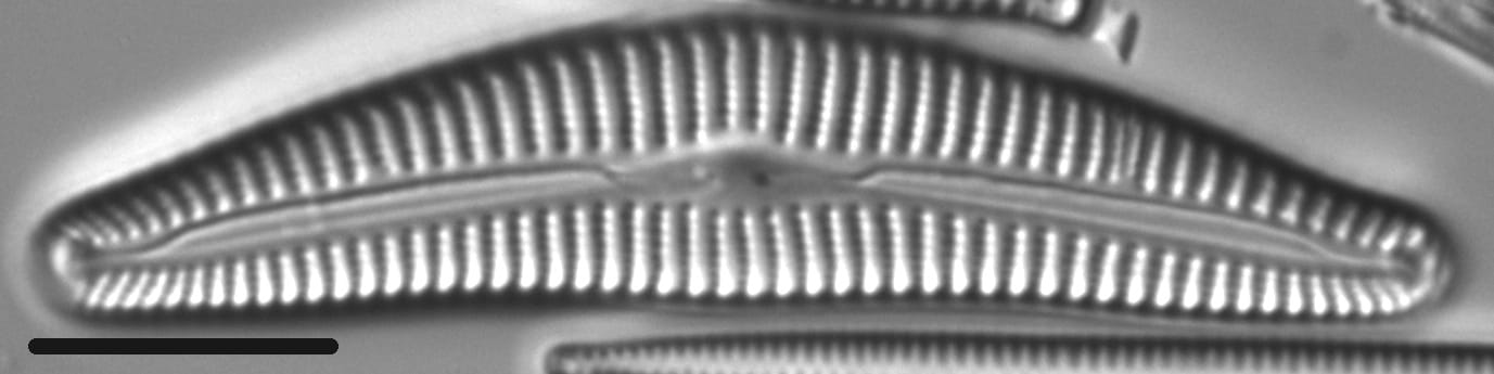 Cymbella alpestris LM5