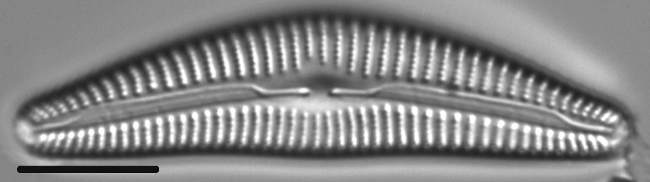 Cymbella alpestris LM6