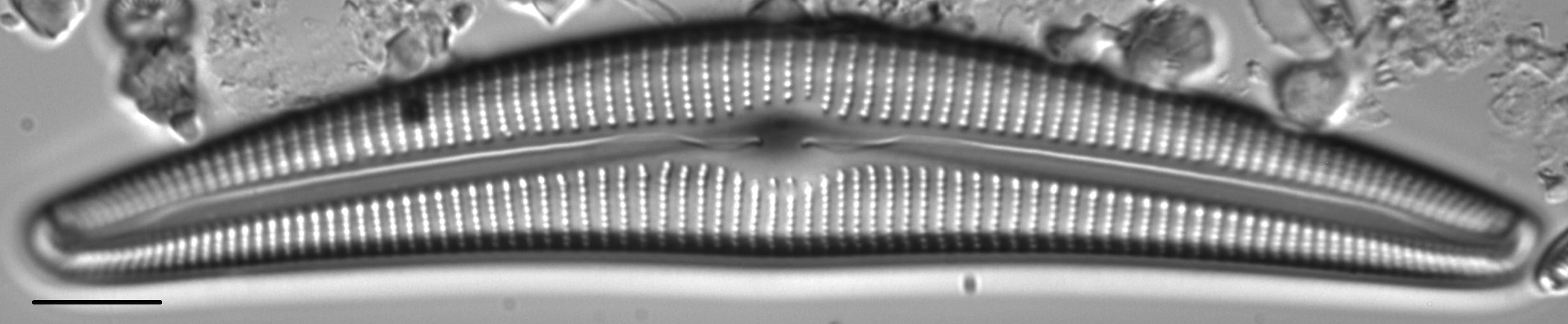 Cymbella Cymbiformis 439301 1