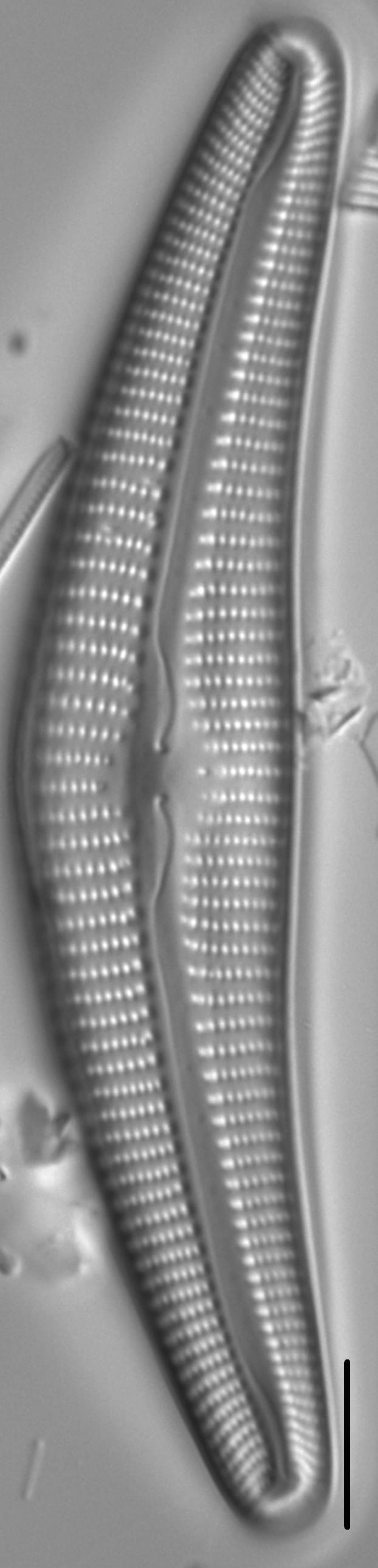 Cymbella Cymbiformis 439301 2