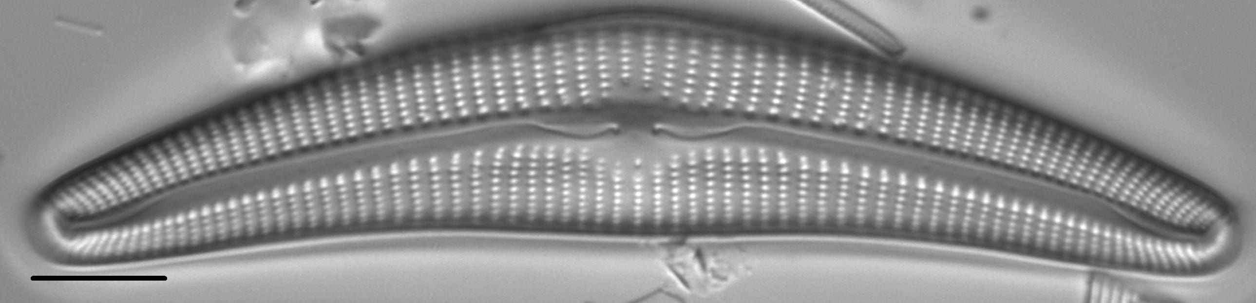 Cymbella Cymbiformis 439301 2