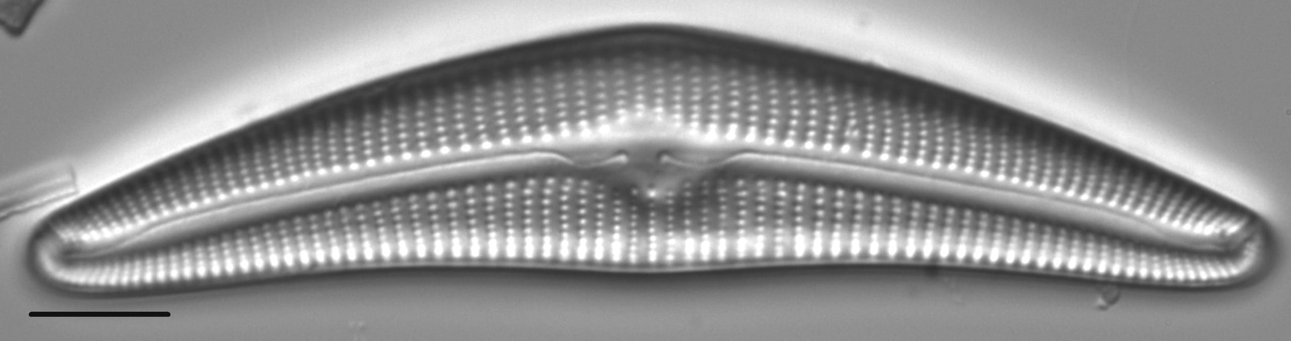 Cymbella Cymbiformis 439301 3