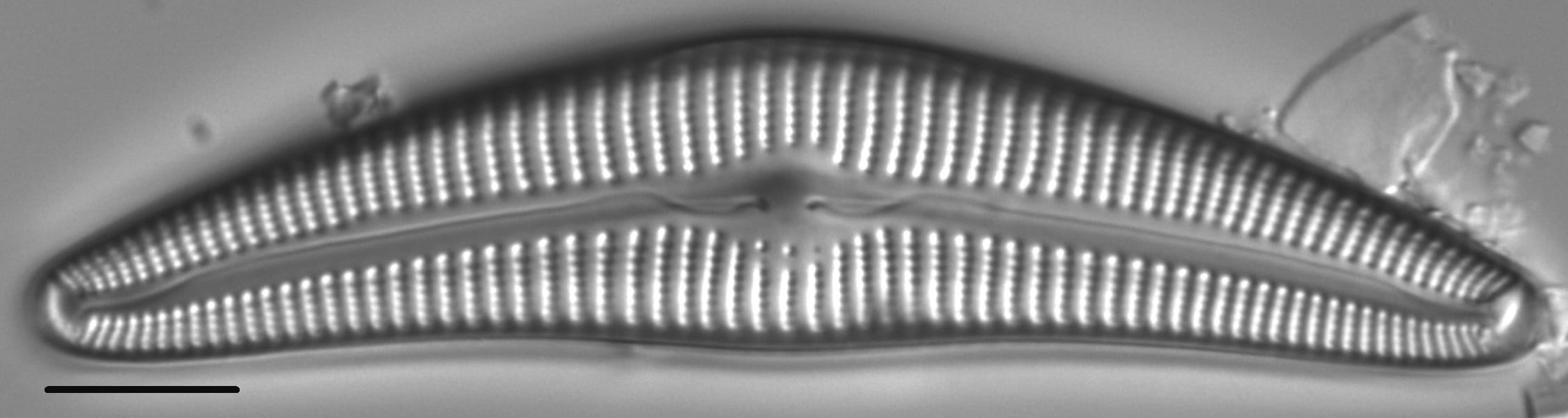 Cymbella Cymbiformis 439301 4