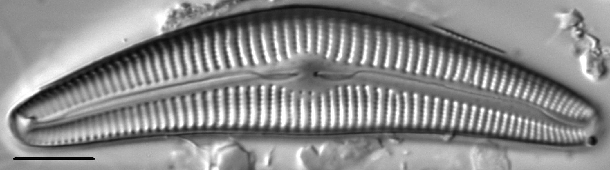 Cymbella Cymbiformis 439301 5