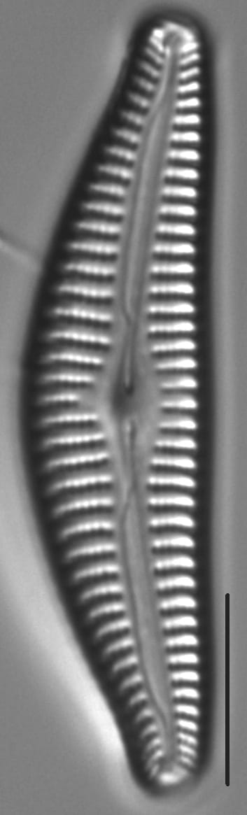 Cymbella Hantzschiana4