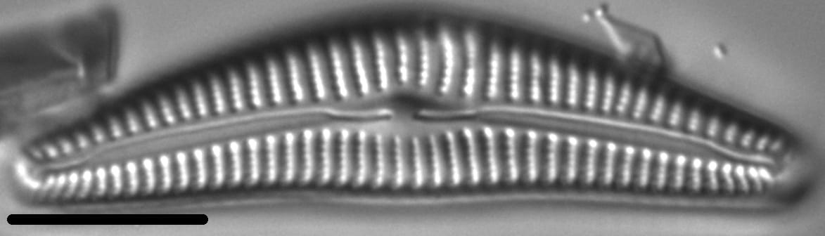 Cymbella hantzschiana LM2