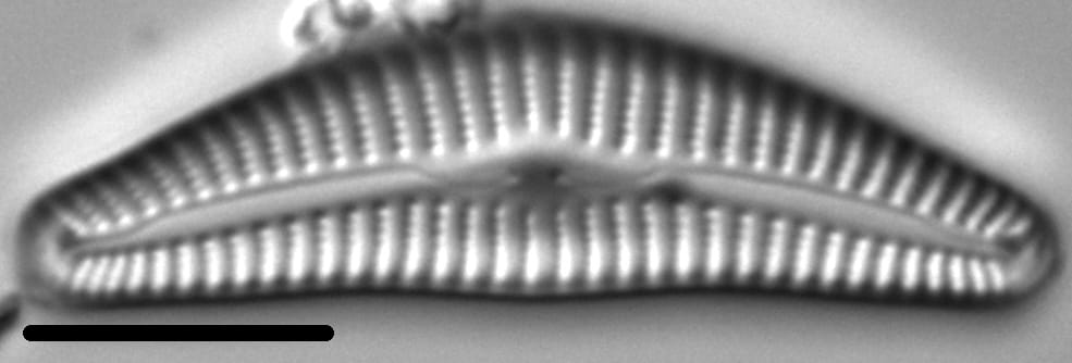 Cymbella hantzschiana LM1