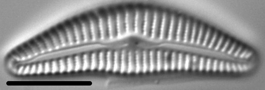 Cymbella hantzschiana LM5