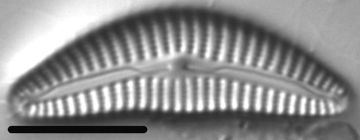 Cymbella hantzschiana LM7