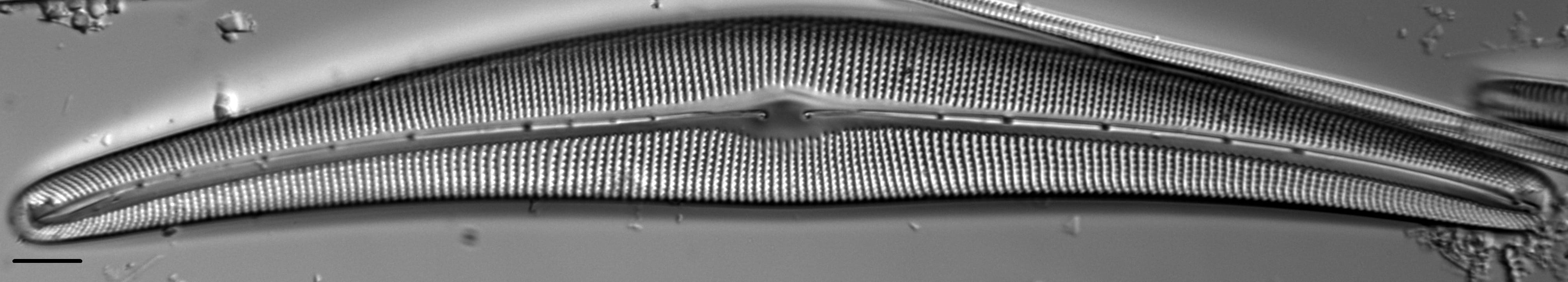 Cymbella Lanceolata1