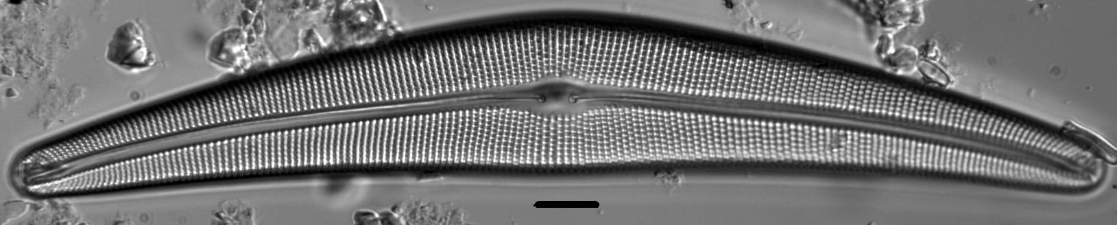 Cymbella Lanceolata3