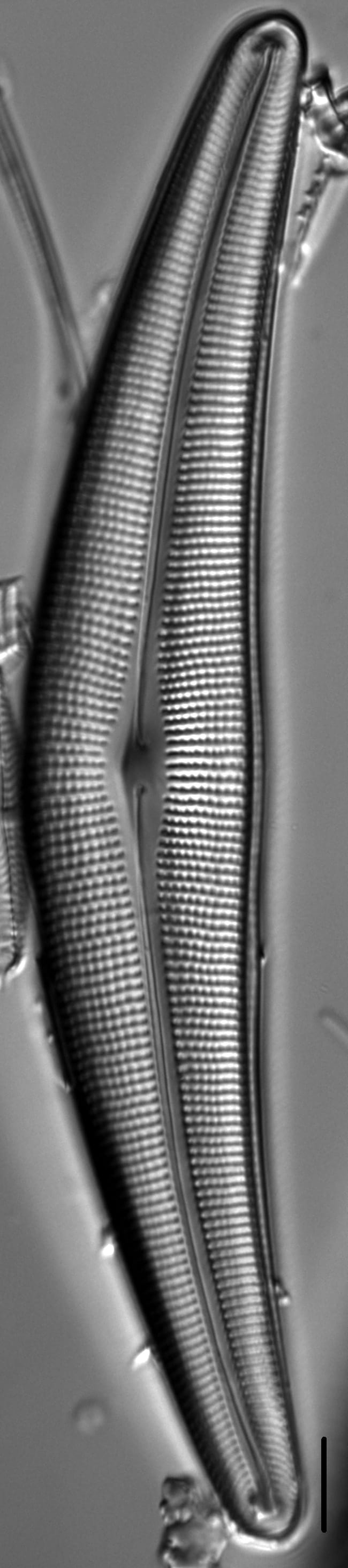 Cymbella Lanceolata4