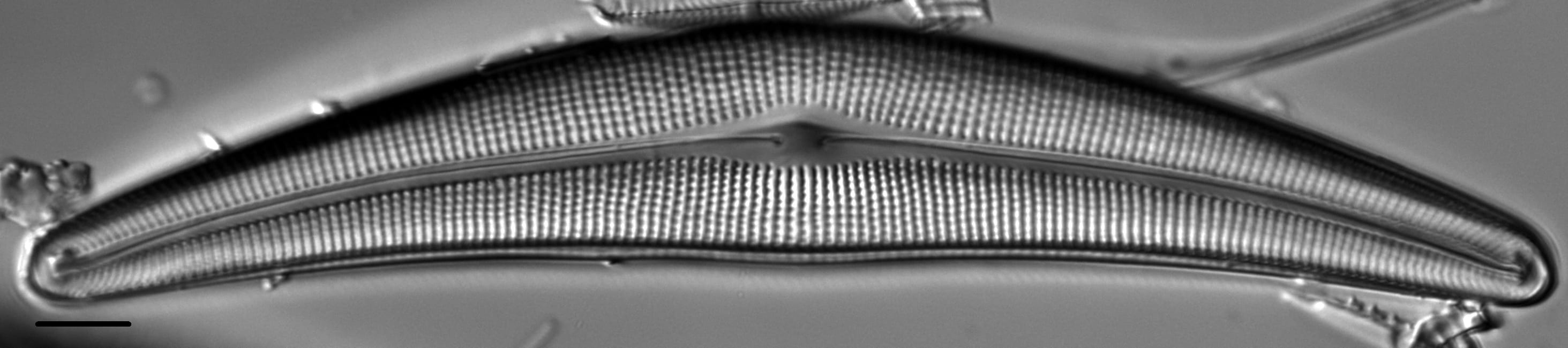 Cymbella Lanceolata4