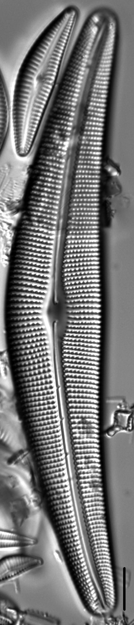 Cymbella Lanceolata5