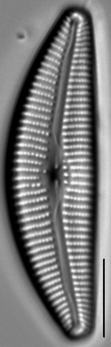 Cymbella Lange Bertalotii7