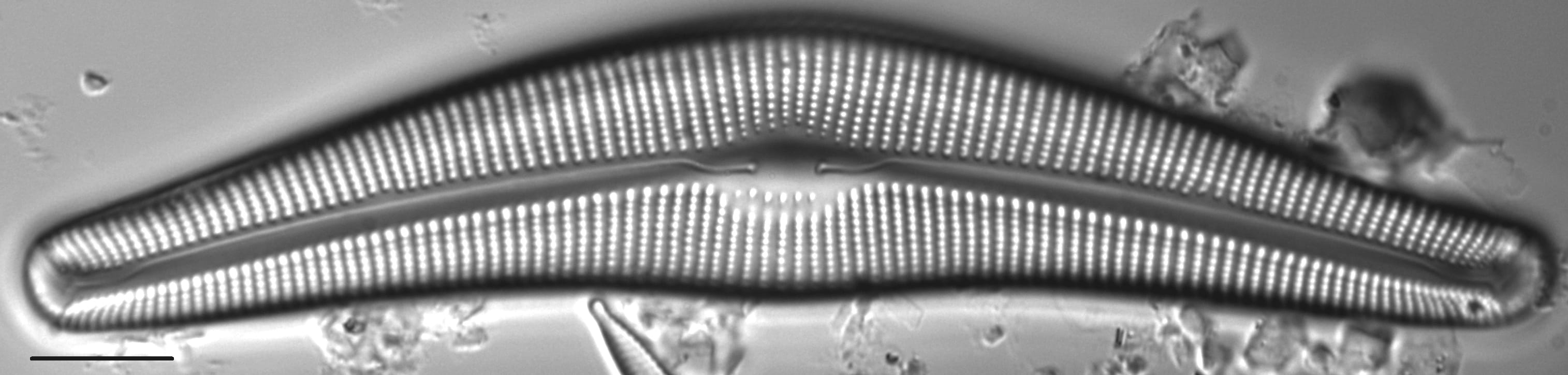 Cymbella Neocistula Islandica1