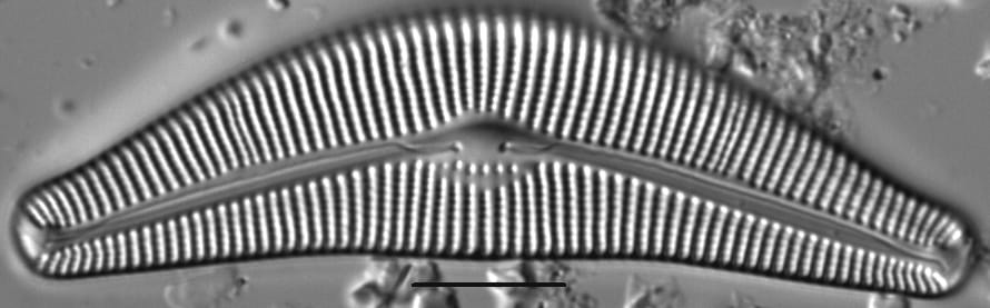 Cymbella Neocistula Islandica4