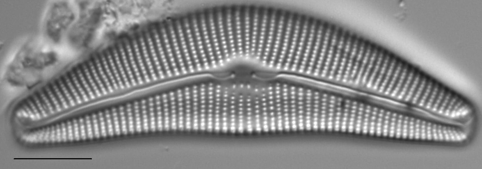 Cymbella Neocistula Islandica5