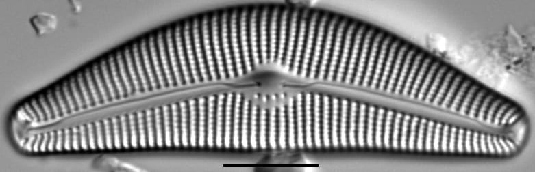 Cymbella Neocistula Islandica6