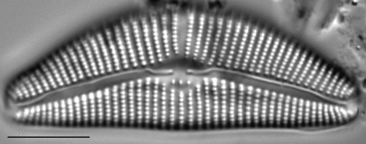 Cymbella Neocistula Islandica7