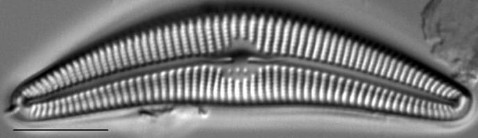 Cymbella Sp 493501 2