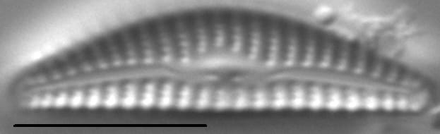 Cymbella cosleyi LM5