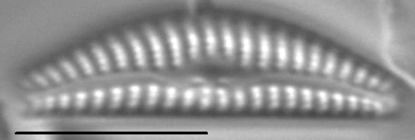 Cymbella cosleyi LM6