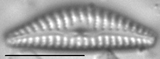 Cymbella cosleyi LM7