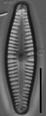 Cymbellafalsa diluviana LM 7
