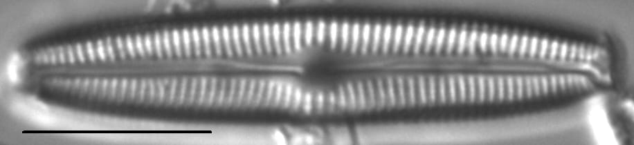 Cymbopleura inceriformis v laterostrata LM5