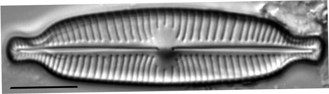 Cymbopleura elliptica LM1