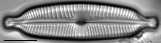 Cymbopleura elliptica LM2