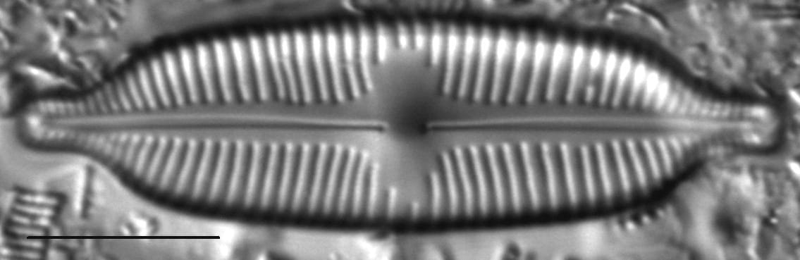 Cymbopleura elliptica LM5