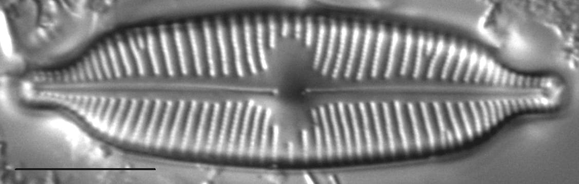 Cymbopleura elliptica LM6